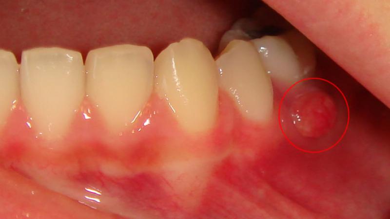 Dental Apse