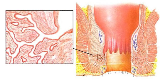 Perianal Apse